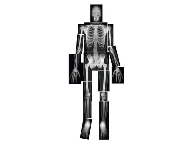 Emberi röntgenkép